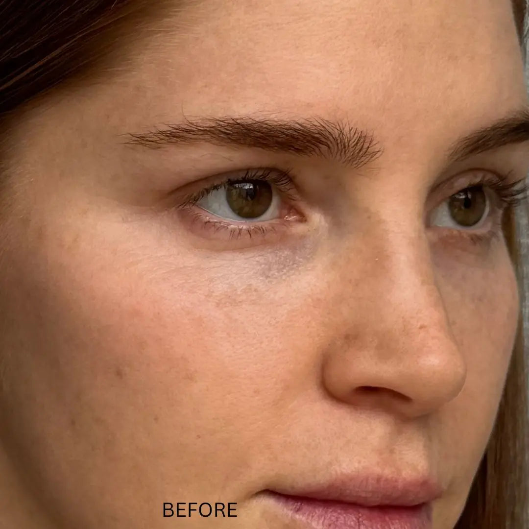 before applying the face and neck mask