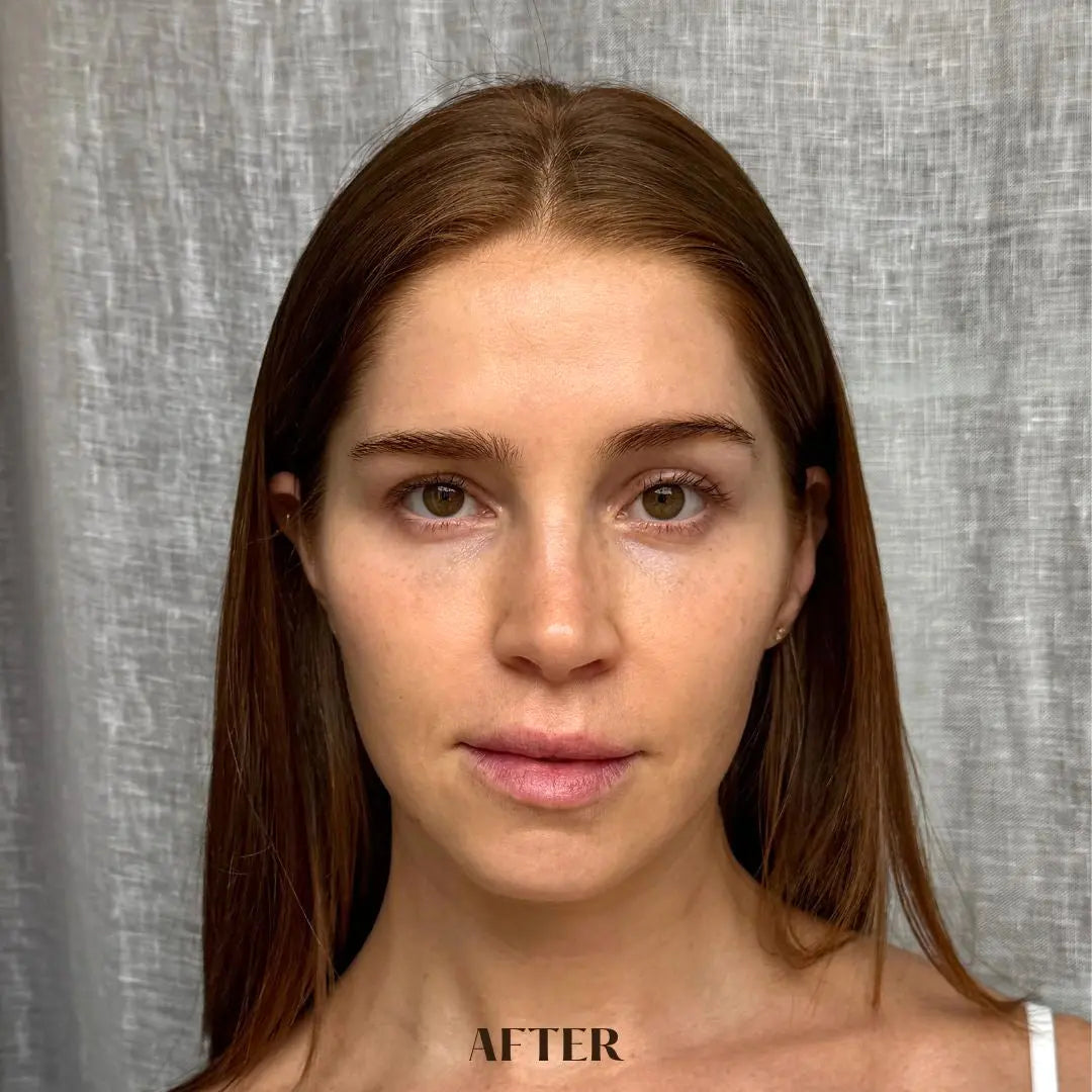 HYALURONIC PLUMPING FACE-NECK MASK after using the mask