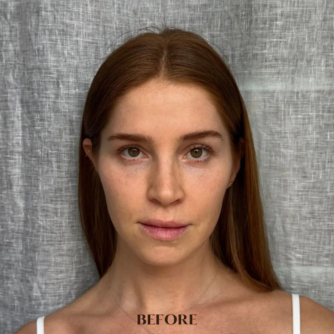HYALURONIC PLUMPING FACE-NECK MASK woman before using the mask