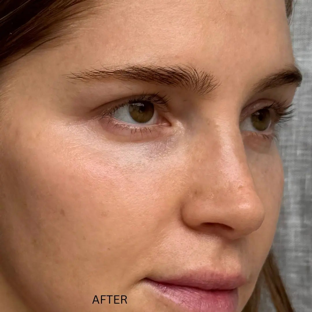 HYALURONIC PLUMPING FACE-NECK after using